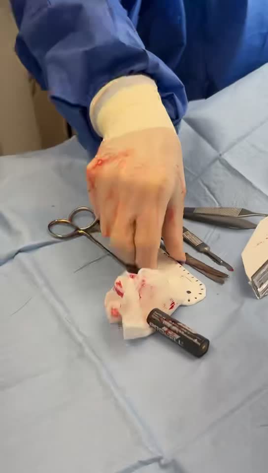 The removed AA battery resting beside gauze on a surgical drape