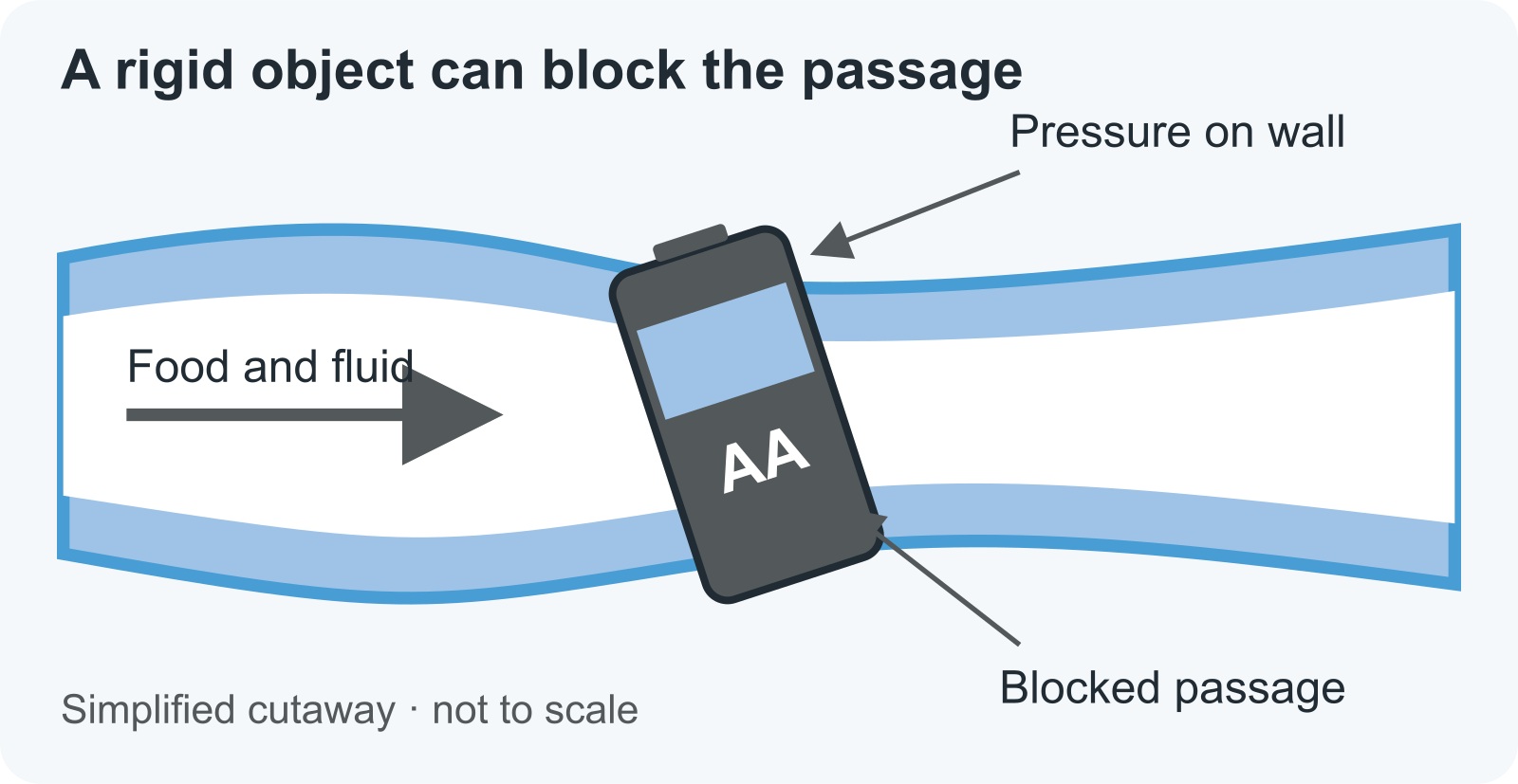 Simplified intestinal cutaway showing an AA battery blocking the passage and pressing on the wall
